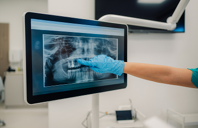 AI Radiograph Analysis